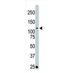 Lymphocyte-Oriented Kinase (LOK) Antibody