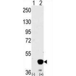 Dual Specificity Mitogen-Activated Protein Kinase Kinase 2 (MEK2) Antibody