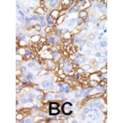 MEK Kinase Kinase 1 (MAP4K1) Antibody