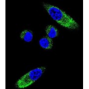 Cytochrome P450 1A1 (CYP1A1) Antibody