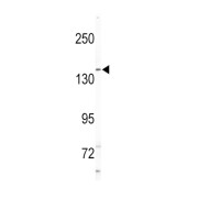 Nck-Interacting Kinase (NIK) Antibody