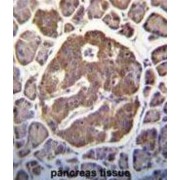 Mitogen-Activated Protein Kinase Kinase Kinase 13 (MAP3K13) Antibody