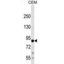 Mitogen-Activated Protein Kinase Kinase Kinase 13 (MAP3K13) Antibody