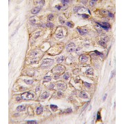 Phosphatidylinositol 4-Phosphate 3-Kinase C2 Domain-Containing Subunit Beta (PI3KC2B) Antibody
