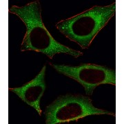 Phosphatidylinositol 4,5-Bisphosphate 3-Kinase Catalytic Subunit Delta Isoform (PI3KCD) Antibody