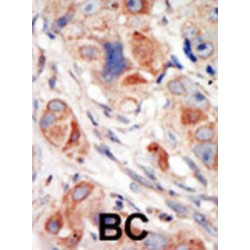 Phosphatidylinositol 4,5-Bisphosphate 3-Kinase Catalytic Subunit Delta Isoform (PI3KCD) Antibody