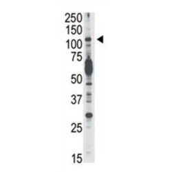 Phosphatidylinositol 4,5-Bisphosphate 3-Kinase Catalytic Subunit Delta Isoform (PI3KCD) Antibody