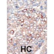 Phosphoinositide 3-Kinase Regulatory Subunit 4 (PI3KR4) Antibody