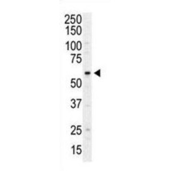 Phosphatidylinositol 4-Kinase Type 2 Alpha (PI4K2A) Antibody