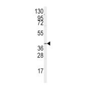 Guanine Nucleotide-Binding Protein Subunit Alpha-12 (GNA12) Antibody