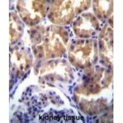 Transient Receptor Potential Cation Channel Subfamily M Member 6 (TRPM6) Antibody