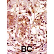 Mitotic Checkpoint Serine/threonine-Protein Kinase BUB1 (BUB1) Antibody