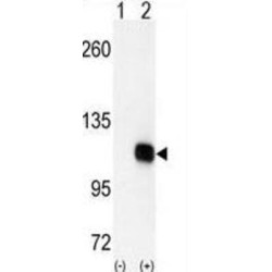 Diacylglycerol Kinase Zeta (DGKZ) Antibody