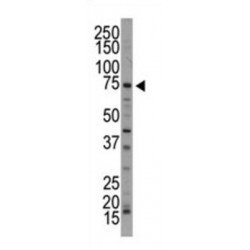 NUAK Family SNF1-Like Kinase 1 (ARK5) Antibody