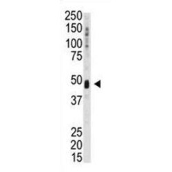 Kinase Interacting With Stathmin (KIST) Antibody