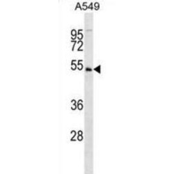 Kinase Interacting With Stathmin (KIST) Antibody