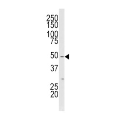 Mixed Lineage Kinase-Related Kinase (MLKLAK) Antibody