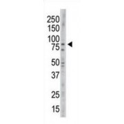 NEK11L Antibody