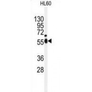 Serine, Threonine-Protein Kinase Nek2 (NEK2) Antibody