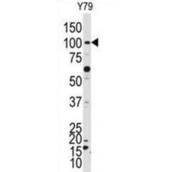 NIMA Related Kinase 4 (NEK4) Antibody