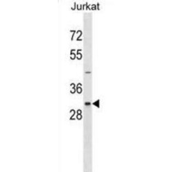Serine/Threonine-Protein Kinase Nek7 (NEK7) Antibody