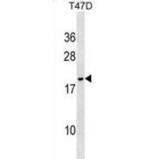 NME/NM23 Nucleoside Diphosphate Kinase 6 (NME6) Antibody