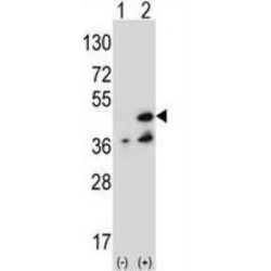 NME/NM23 Family Member 7 (NME7) Antibody