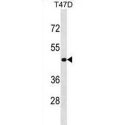 NME/NM23 Family Member 7 (NME7) Antibody