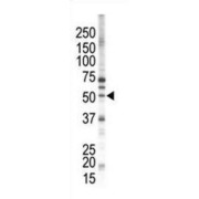 Protein Kinase C And Casein Kinase Substrate In Neurons Protein 1 (PACSIN1) Antibody