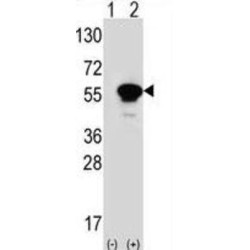 Protein Kinase C And Casein Kinase Substrate In Neurons Protein 1 (PACSIN1) Antibody