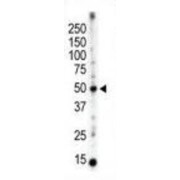 Protein Kinase C And Casein Kinase Substrate In Neurons Protein 3 (PACSIN3) Antibody