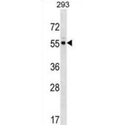 Protein Kinase C And Casein Kinase Substrate In Neurons Protein 3 (PACSIN3) Antibody