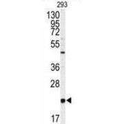 Platelet Basic Protein (PBP) Antibody