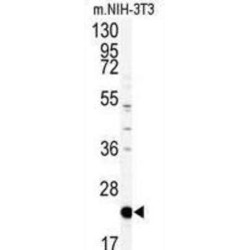 Platelet Basic Protein (PBP) Antibody