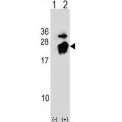 Platelet Basic Protein (PBP) Antibody