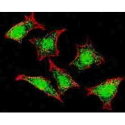 Natriuretic Peptide Receptor C Antibody