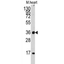 Unc-51 Like Kinase 3 (ULK3) Antibody