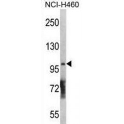 Diacylglycerol Kinase Theta (DGKQ) Antibody