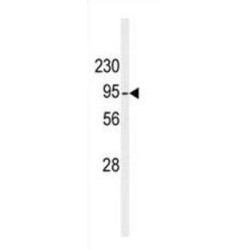 Diacylglycerol Kinase Beta (DGKB) Antibody