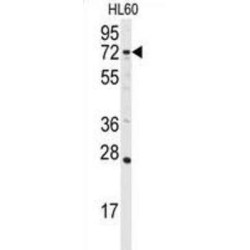 Diacylglycerol Kinase Alpha (DGKA) Antibody