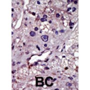 UCK Antibody