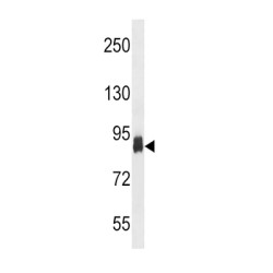 ATP-Dependent 6-Phosphofructokinase, Platelet Type (PFKP) Antibody