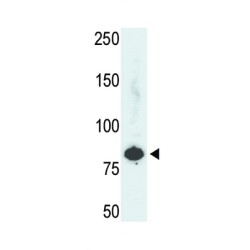 Phosphofructokinase, Liver (PFKL) Antibody
