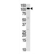 Hexokinase 3 (HK3) Antibody