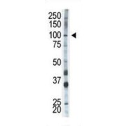 Hexokinase 1 (HK1) Antibody