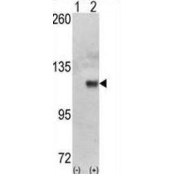 Hexokinase 1 (HK1) Antibody