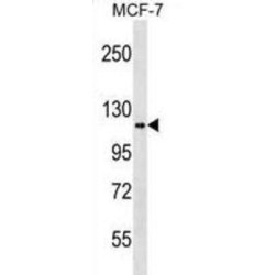 Hexokinase 1 (HK1) Antibody