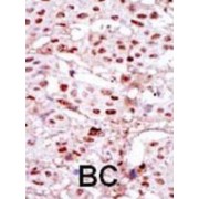 Casein Kinase II Subunit Alpha (CKII alpha) Antibody