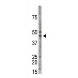 Casein Kinase II Subunit Alpha (CKII alpha) Antibody