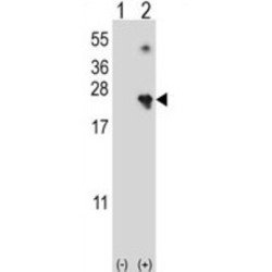 Nucleoside Diphosphate Kinase, Mitochondrial (NME4) Antibody